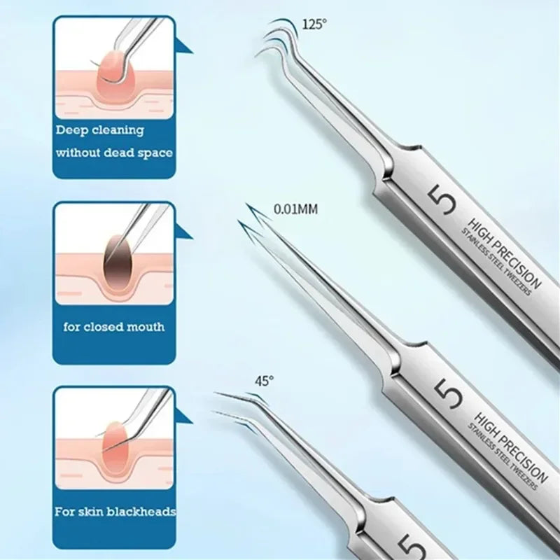 Acne Blackhead Removal Kit